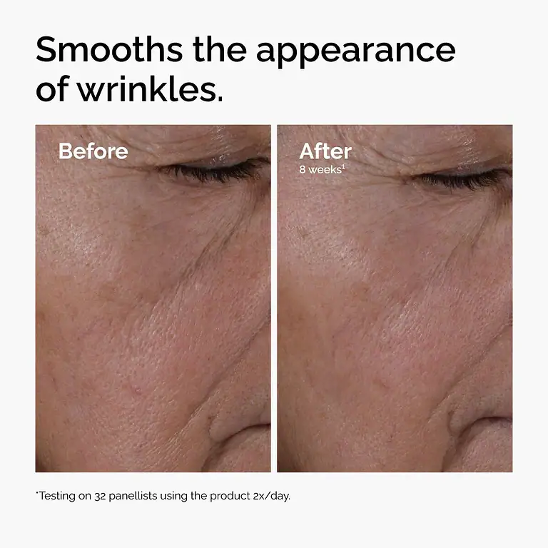 THE ORDINARY MULTI-PEPTIDE + HA SERUM – 3 thumbnail 5