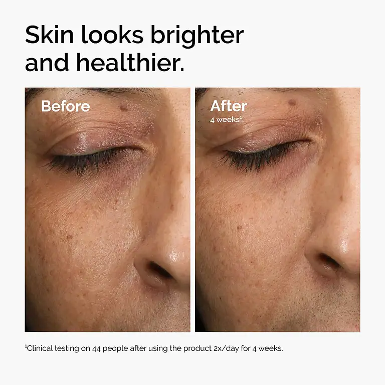 THE ORDINARY MULTI – ANTIOXIDANT RADIANCE SERUM thumbnail 2