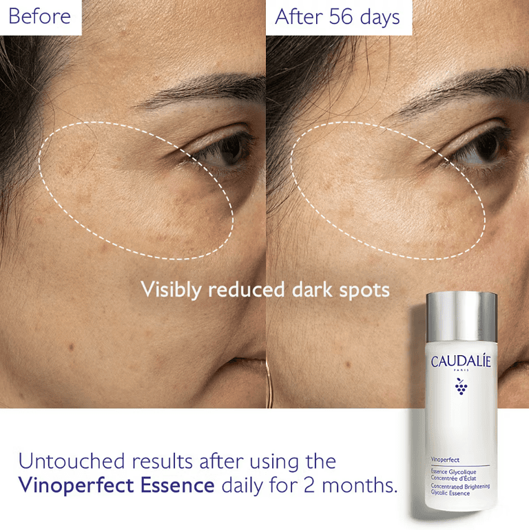 Caudalie Vinoperfect Concentrated Brightening Glycolic Acid Essence thumbnail 4